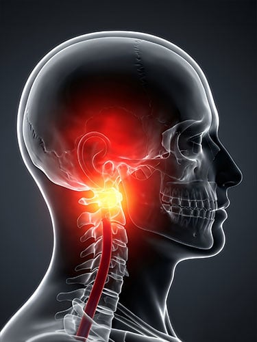 Traumatic Brain Injury and Neck Injury